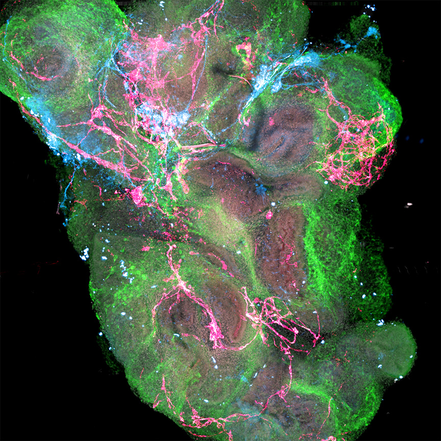 static-image-organoid GastroScreen