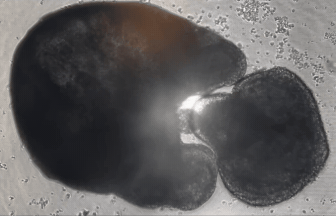Adobe Express - GastroScreen_Peristalsis_OG
